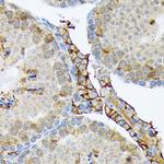 PLTP Recombinant Rabbit Monoclonal Antibody (6A1Q1)