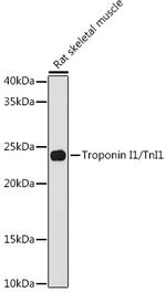 TNNI1 Recombinant Rabbit Monoclonal Antibody (5K1U2)