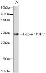 TNNI1 Antibody in Western Blot (WB)