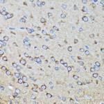 RALBP1 Antibody in Immunohistochemistry (Paraffin) (IHC (P))