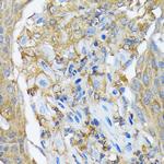 RALBP1 Antibody in Immunohistochemistry (Paraffin) (IHC (P))