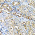 RALBP1 Antibody in Immunohistochemistry (Paraffin) (IHC (P))