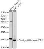 PTH Recombinant Rabbit Monoclonal Antibody (5X6R6)