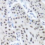 SMN1 Recombinant Rabbit Monoclonal Antibody (9N9Q6)