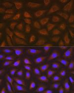 EEF2 Antibody in Immunocytochemistry (ICC/IF)
