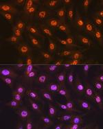 SF3B1 Recombinant Rabbit Monoclonal Antibody (4A3G9)