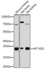 MT-ND1 Recombinant Rabbit Monoclonal Antibody (5J5C8)