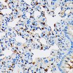 POLR2C Antibody in Immunohistochemistry (Paraffin) (IHC (P))