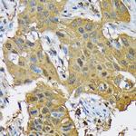POLR2C Antibody in Immunohistochemistry (Paraffin) (IHC (P))