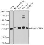 POLR2C Antibody in Western Blot (WB)