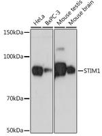 STIM1 Recombinant Rabbit Monoclonal Antibody (1Z7E3)