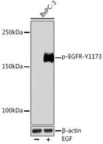 Phospho-EGFR (Tyr1173) Antibody in Western Blot (WB)
