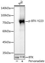 Phospho-BTK (Tyr223) Recombinant Rabbit Monoclonal Antibody (10F4W10)