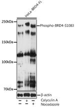 Phospho-BRD4 (Ser1083) Recombinant Rabbit Monoclonal Antibody (5B6X4)