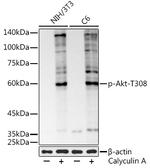 Phospho-AKT Pan (Thr308, Thr305, Thr309) Recombinant Rabbit Monoclonal Antibody (5E9G5)