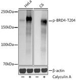 Phospho-BRD4 (Thr204) Recombinant Rabbit Monoclonal Antibody (3V5R1)