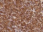 TCERG1L Monoclonal Antibody (05)