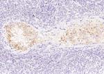 AMH Monoclonal Antibody (14)