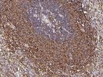 CCR1 Antibody in Immunohistochemistry (Paraffin) (IHC (P))