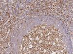 CCR1 Antibody in Immunohistochemistry (Paraffin) (IHC (P))