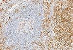 CD7 Recombinant Rabbit Monoclonal Antibody (15)