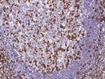 IFITM1 Antibody in Immunohistochemistry (Paraffin) (IHC (P))