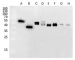 RSV Fusion Protein Recombinant Rabbit Monoclonal Antibody (R338)
