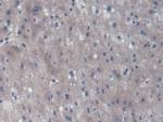 UCP2 Antibody in Immunohistochemistry (Paraffin) (IHC (P))