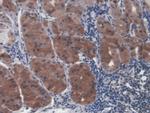 UCP2 Antibody in Immunohistochemistry (Paraffin) (IHC (P))