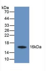 TMEM27 Monoclonal Antibody (C5)