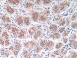 ST14 Antibody in Immunohistochemistry (Paraffin) (IHC (P))