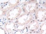 ST14 Antibody in Immunohistochemistry (Paraffin) (IHC (P))
