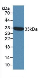 ST14 Antibody in Western Blot (WB)