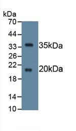 SPINK5 Monoclonal Antibody (C10)