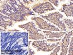 SFRP4 Antibody in Immunohistochemistry (Paraffin) (IHC (P))