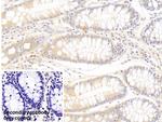 SFRP4 Antibody in Immunohistochemistry (Paraffin) (IHC (P))
