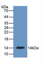 SFRP4 Antibody in Western Blot (WB)