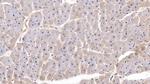 SFRP1 Monoclonal Antibody (C5)