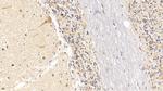 SEMA5B Antibody in Immunohistochemistry (Paraffin) (IHC (P))