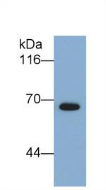 SEMA5B Antibody in Western Blot (WB)