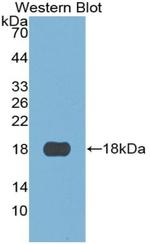 S100A3 Antibody in Western Blot (WB)