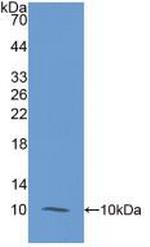 S100A12 Antibody in Western Blot (WB)