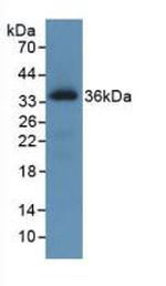 ROS1 Monoclonal Antibody (C1)