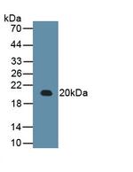 RARS Monoclonal Antibody (C9)