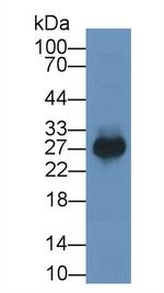 PTGDS Antibody in Western Blot (WB)