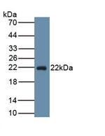 PTGDS Antibody in Western Blot (WB)