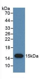 PSCA Monoclonal Antibody (C1)