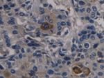 ORM2 Monoclonal Antibody (D7)