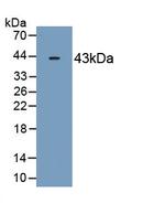 OAS2 Monoclonal Antibody (C1)
