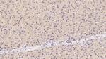OAS1 Monoclonal Antibody (C5)